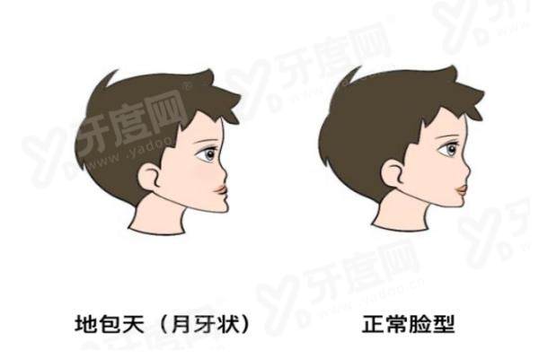 烟台八角壹颗芽口腔门诊部种植牙多少钱一颗？单颗 3k+ 半口全口价目表一览