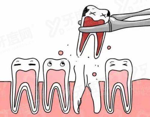二、北京极简海德堡口腔种植牙价格yanke.yadoo.cn