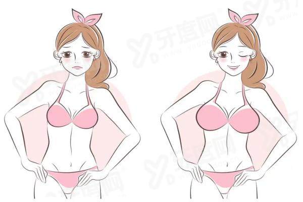 北京圣嘉新医疗美容医院怎么样？5A 级资质放心，自体脂肪丰胸自然饱满值得冲