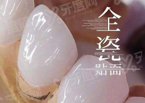 二、合肥中诺口腔医院种植牙全口多少钱yanke.yadoo.cn