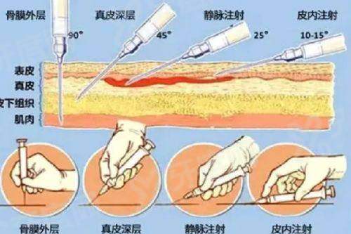 长沙祺美整形假体隆胸多少钱？3 万起选傲诺拉，甜伊严选预约查底价更安心