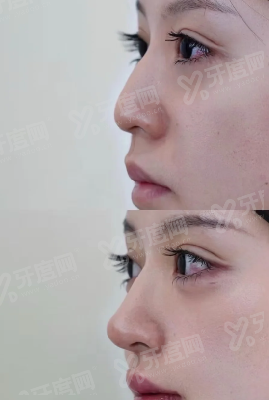重庆星荣美容刘正茂院长颌面骨性调整好？磨骨多少钱自然不垮脸，甜伊严选小程序查询