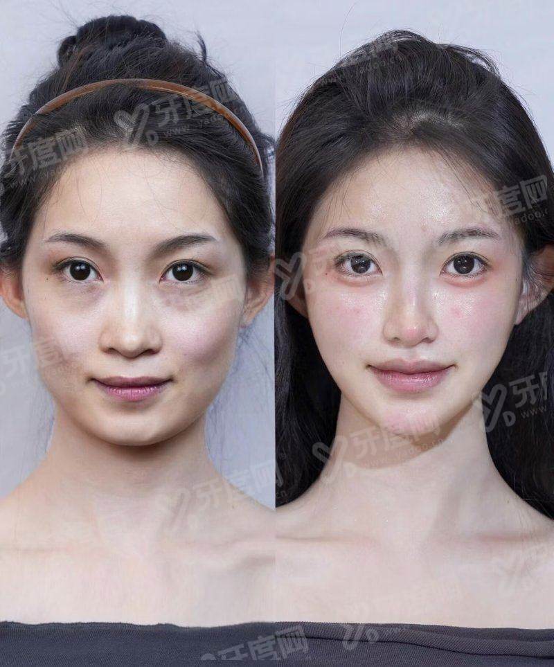 总结:选对方案,逆龄不难yanke.yadoo.cn