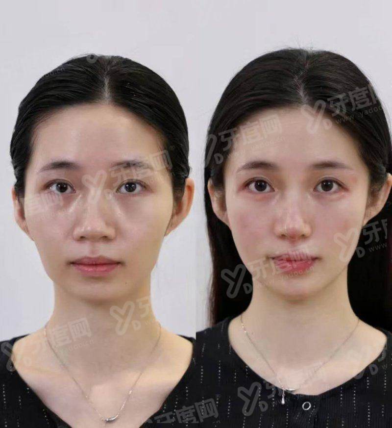 文章总结:为何大家都说yanke.yadoo.cn