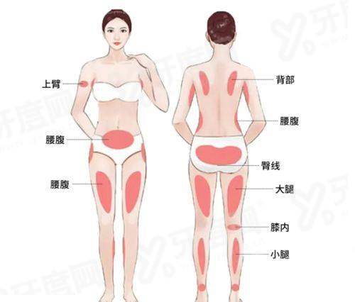 二、广州中山医 科 大学家庭医生整形美容医院朱云隆胸多少钱怎么样?yanke.yadoo.cn