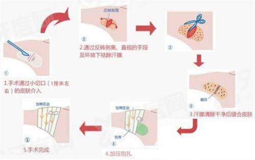 二、广州曙光医学美容医院黄金微针不贵怎么样?yanke.yadoo.cn