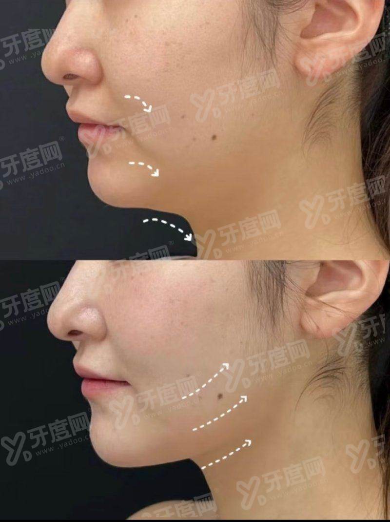 二、上海艺星整形医院法定预约入口|怎么联系医院预约光子嫩肤上甜伊严选一键预约,预约流程更简单怎么样?yanke.yadoo.cn