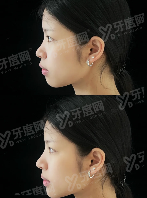 三、总结与建议yanke.yadoo.cn