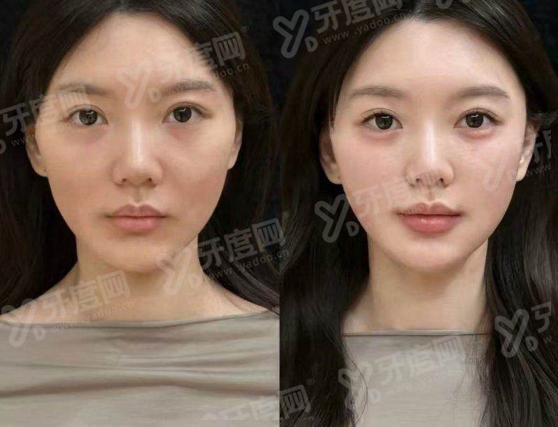 二、广州曙光皮肤激光项目价格？上甜伊严选预约怎么样？yanke.yadoo.cn