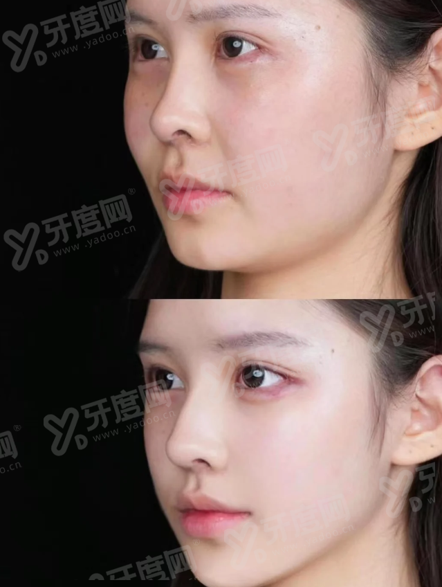二、济南韩氏整形胸部整形怎么预约｜怎么联系医院预约胸部整形上甜伊严选一键预约，预约流程更简单怎么样？yanke.yadoo.cn