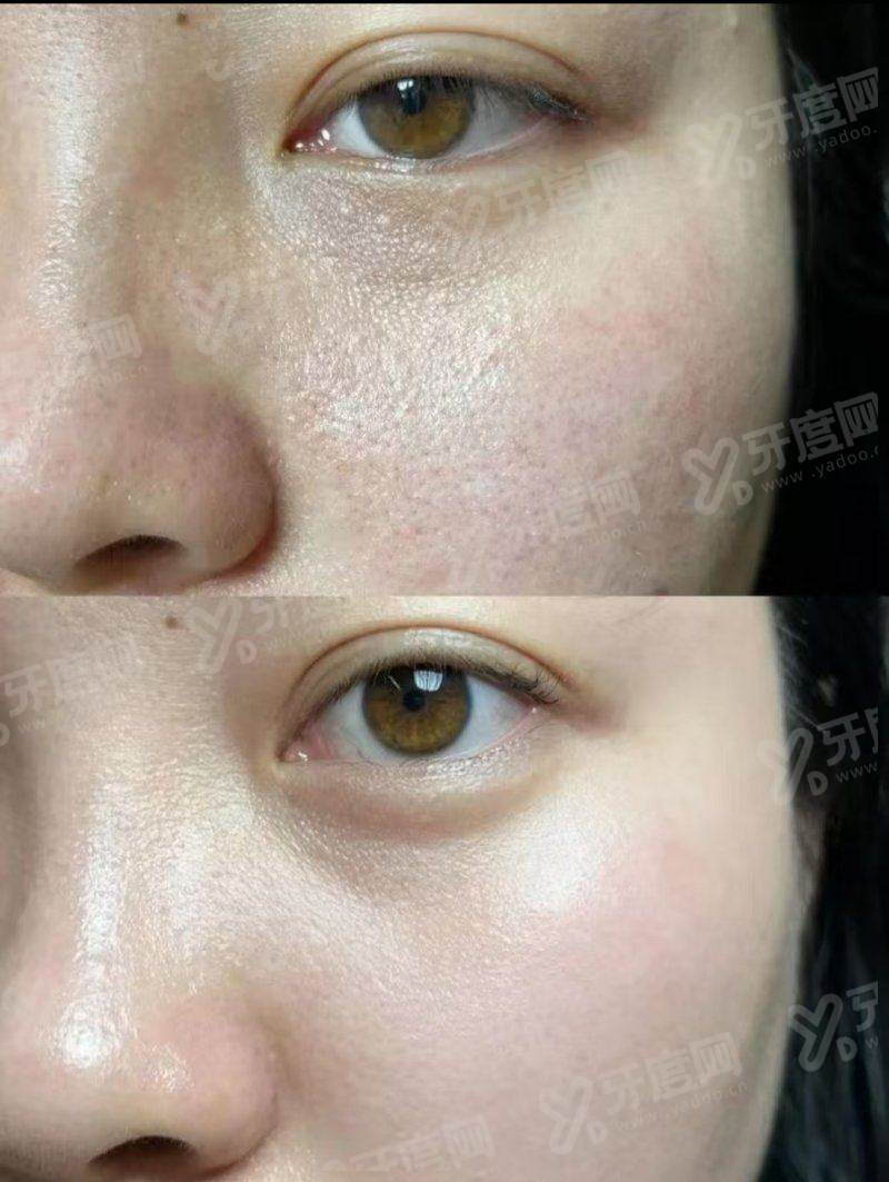 二、上海华美整形面部微整怎么预约｜怎么联系医院预约面部微整上甜伊严选一键预约，预约流程更简单怎么样？yanke.yadoo.cn