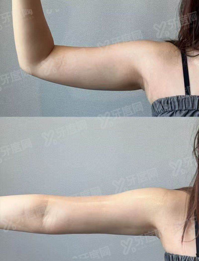 二、深圳伽美贝拉医疗美容连锁黄金超光子怎么预约|怎么联系医院预约黄金超光子上甜伊严选一键预约,预约流程更简单怎么样?yanke.yadoo.cn
