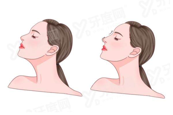 杭州艺星医疗美容医院官方预约入口？甜伊严选可以预约直达官方预约通道，一键锁定名医档期！