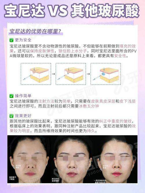 二、香港全之妍 All beauty 医美玻尿酸注射如何递交预约申请?通过甜伊严选申领面诊预约名额怎么样?yanke.yadoo.cn