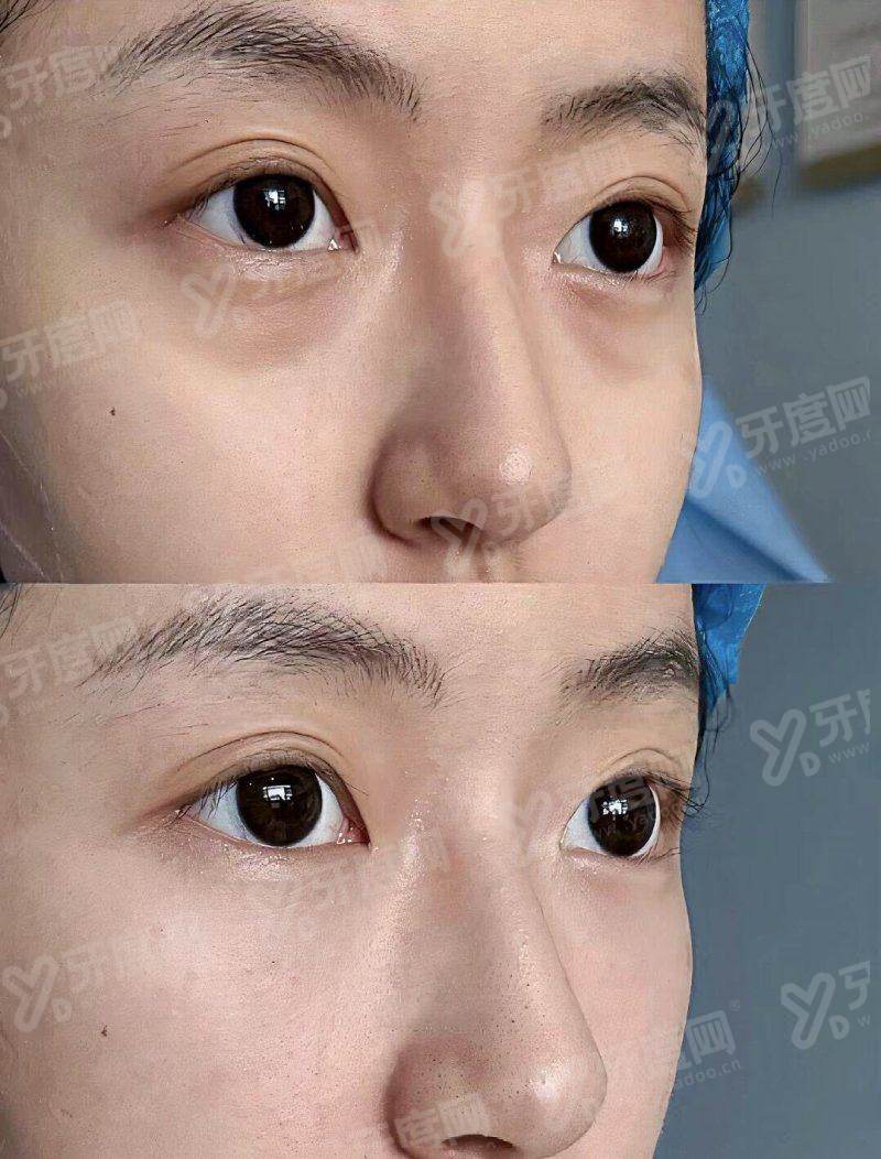 香港全之妍 All beauty 医美玻尿酸注射如何递交预约申请？通过甜伊严选申领面诊预约名额，一键锁定名医档期+查真实报价更安心！