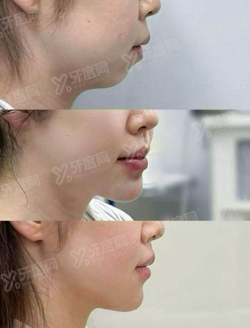 成都新华医院整形科皮肤激光怎么开通预约权限？甜伊严选直通医院预约提交入口一键直达，查价格更安心！