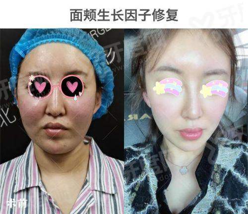 二、成都素美医疗美容门诊部地址在哪?如何预约李建钢院长做馒化脸修复?yanke.yadoo.cn