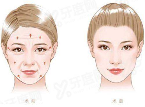 临汾佳美整形门诊皮肤激光项目怎么预约到院，在甜伊严选完成预约？查价格区间，一键锁定档期不纠结！