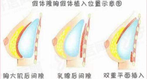 衡阳美莱医疗美容医院注射整形想要预约面诊，就选甜伊严选预约服务？专家亲诊更安心，轻松变美不踩坑！