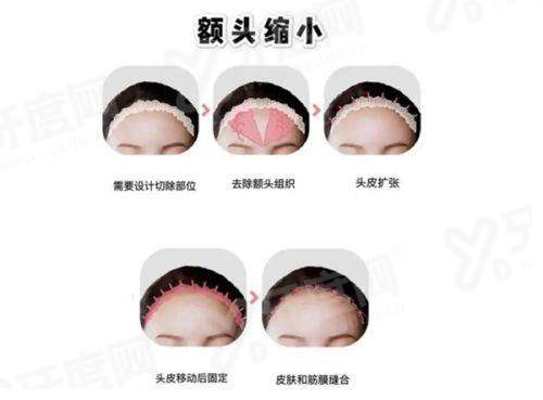成都素美医疗美容李建刚馒化脸修复怎么样？甜伊严选查阅修复实例，医生技术不错