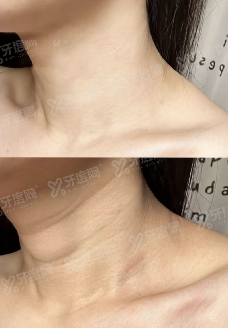 北京圣嘉新医疗美容口腔医院大脚骨整形预约入口，找甜伊严选预约咨询苏敬达微创美足
