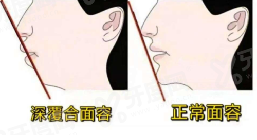 2026北京汉尊口腔门诊收费高吗？不高，隐形矫正 2 万 + 种植牙 5 千起超值