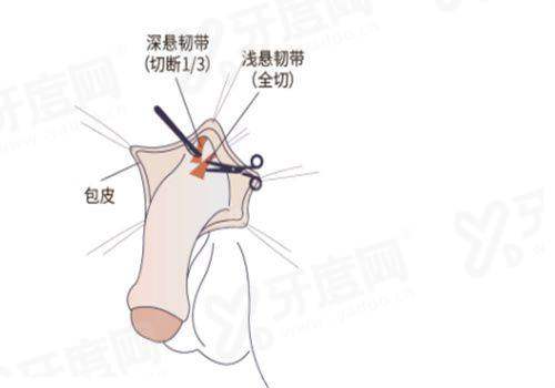 goldj 皮肤科应该怎么查询预约，通过首尔 Eonni 小程序预约专家