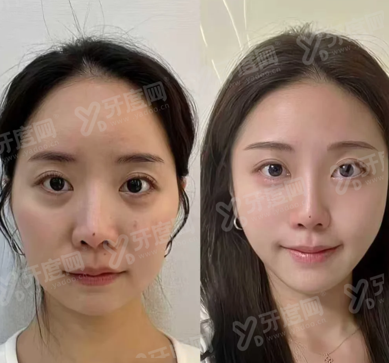 二、CNP 皮肤科狎鸥亭店皮肤科痘痘肌管理适合敏感肌吗?首尔 Eonni 一键搞定怎么预约挂号怎么样?yanke.yadoo.cn