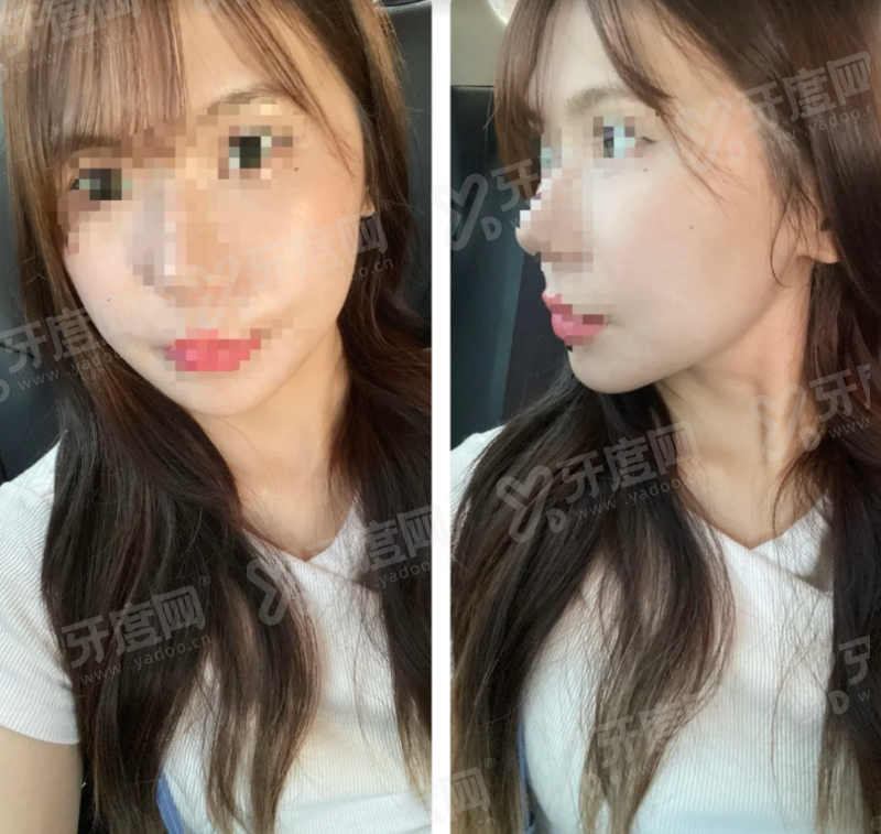 二、首尔弘大皮肤科哪家无套路?|弘大思丽本皮肤科 JD 皮肤科首尔 Eonni 手把手教挂号怎么预约挂号怎么样?yanke.yadoo.cn
