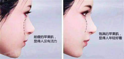 三、在韩国弘大凯特皮肤科进行热门项目的大致费用是多少?yanke.yadoo.cn