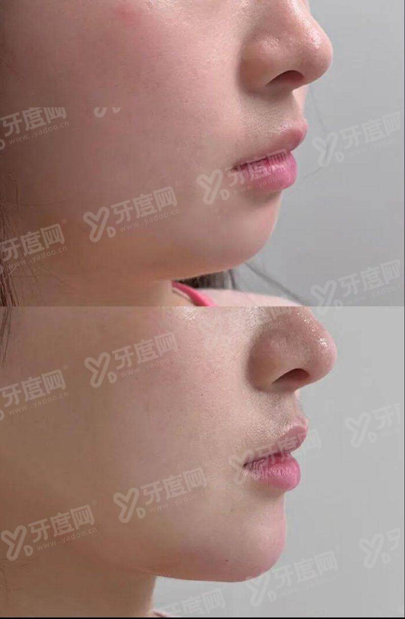 二、韩国juno hair理发店怎么预约挂号?韩国本地预约用首尔Eonni 怎么样?yanke.yadoo.cn