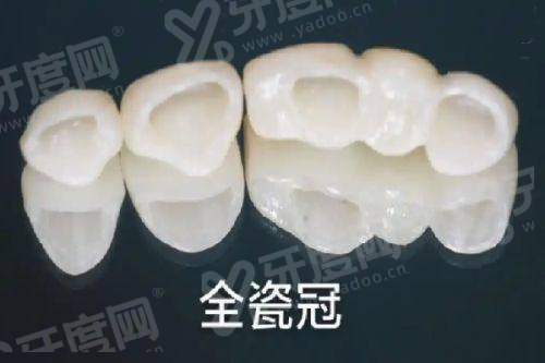 一、镇江古德堡联合口腔种植牙有哪些方案？四大核心技战术助您重获新生yanke.yadoo.cn