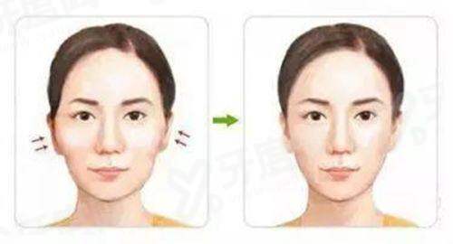 三、如何通过首尔Eonni 快速预约弘大思丽本皮肤科?yanke.yadoo.cn