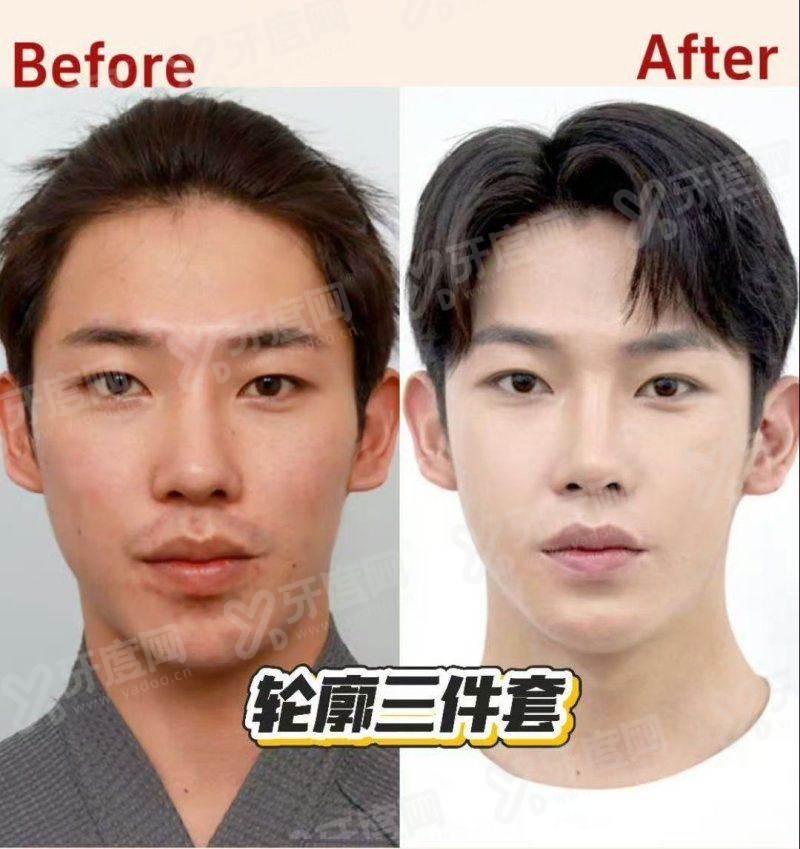 三、选择韩国清潭antian抗衰皮肤科进行跨国就医有哪些便利保护？yanke.yadoo.cn