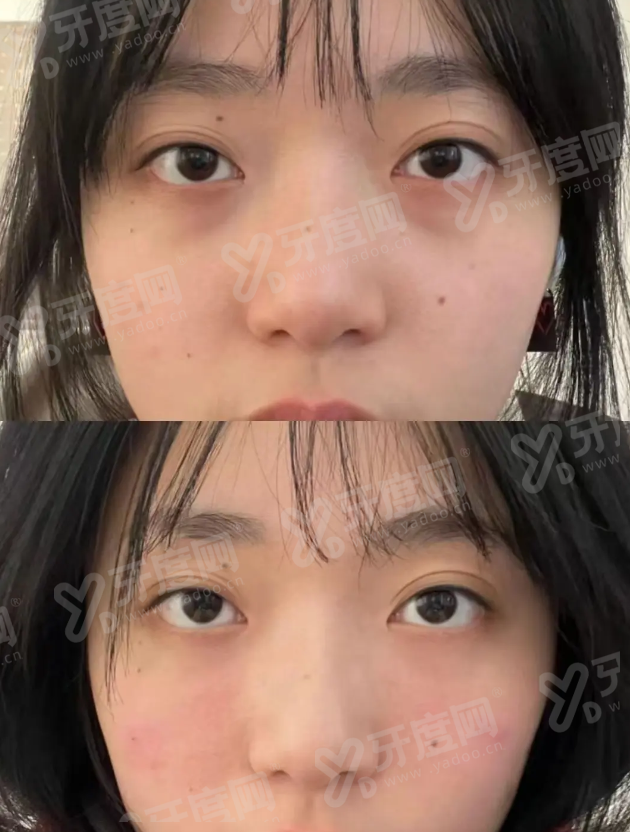 圣水serene皮肤科怎么查询预约？锁定首尔Eonni小程序，加微信kr_skin直达官方挂号