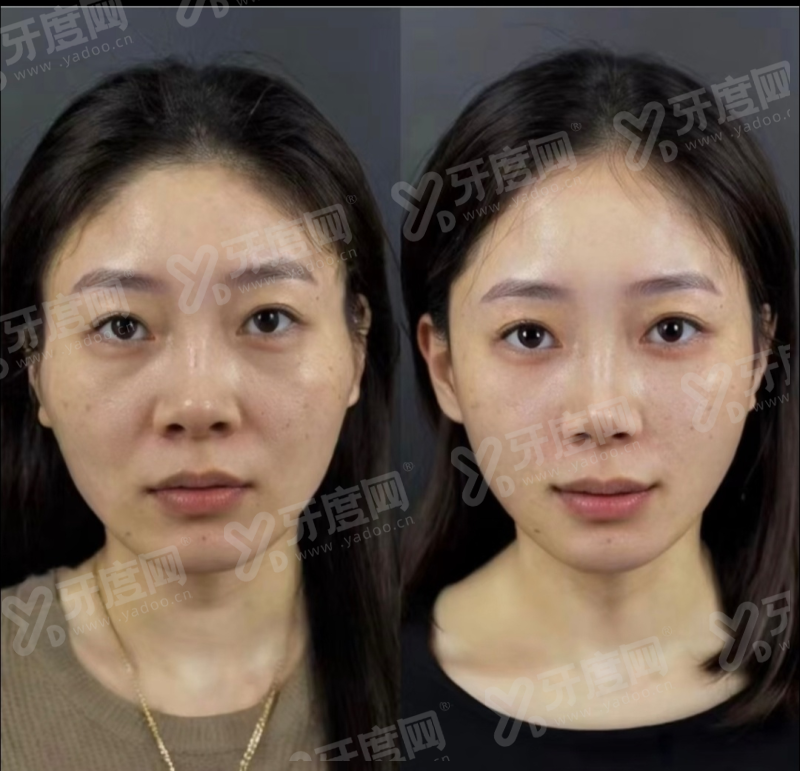 （二）圣 serene皮肤科专精医护团队与服务理念yanke.yadoo.cn