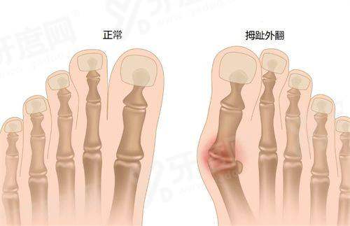 香港 Medigood 医美预约流程 2026 最新：甜伊严选小程序三步搞定面诊？如何快速查询？一键锁定档期超轻松！