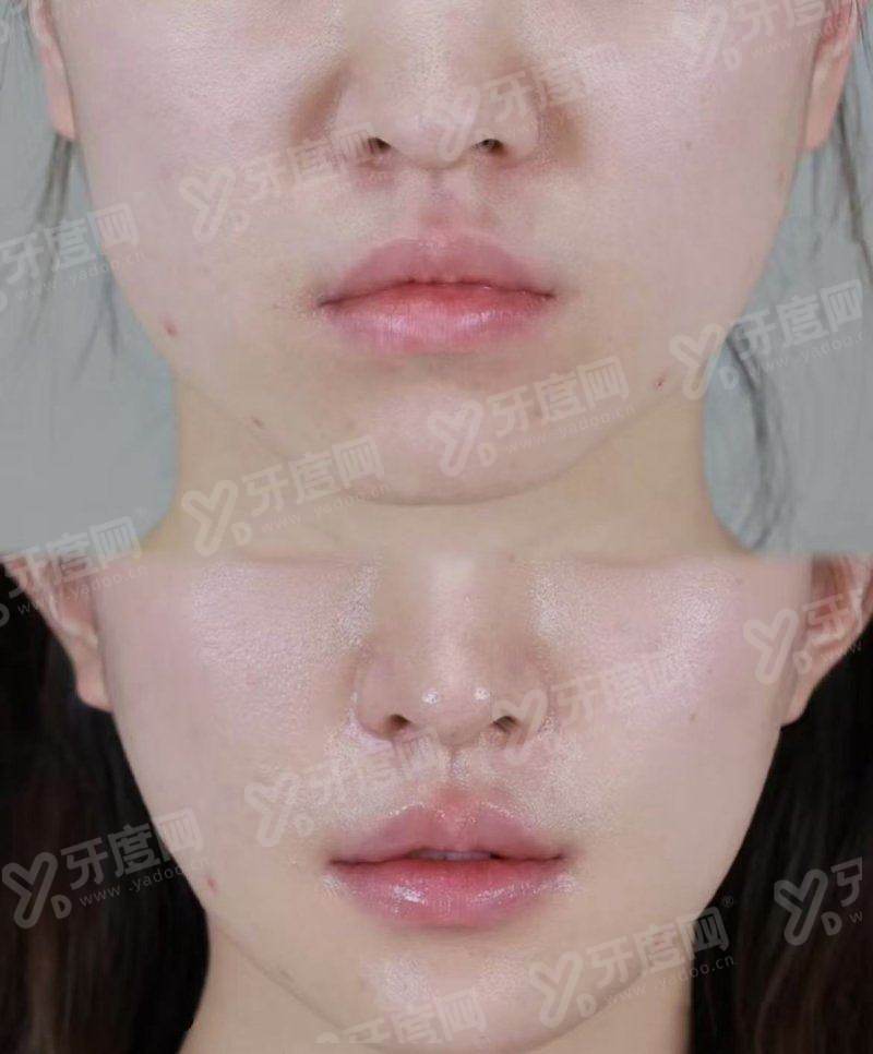 香港海洋极致医美怎么约最方便？甜伊严选小程序一键预约教程来了，查价格秒约，变美超轻松！