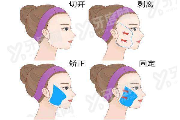 韩国桔艺菲医院江南店怎么预约挂号？江南医美面诊预约首尔Eonni避坑指南一键查询，轻松锁定变美名额！