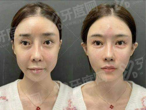二、有意向到香港柔枕柔秈 (xian) GENIC SKIN MEDICAL – COLLAWHITE 医疗美容做医美项目可以通过甜伊严选预约怎么样?yanke.yadoo.cn
