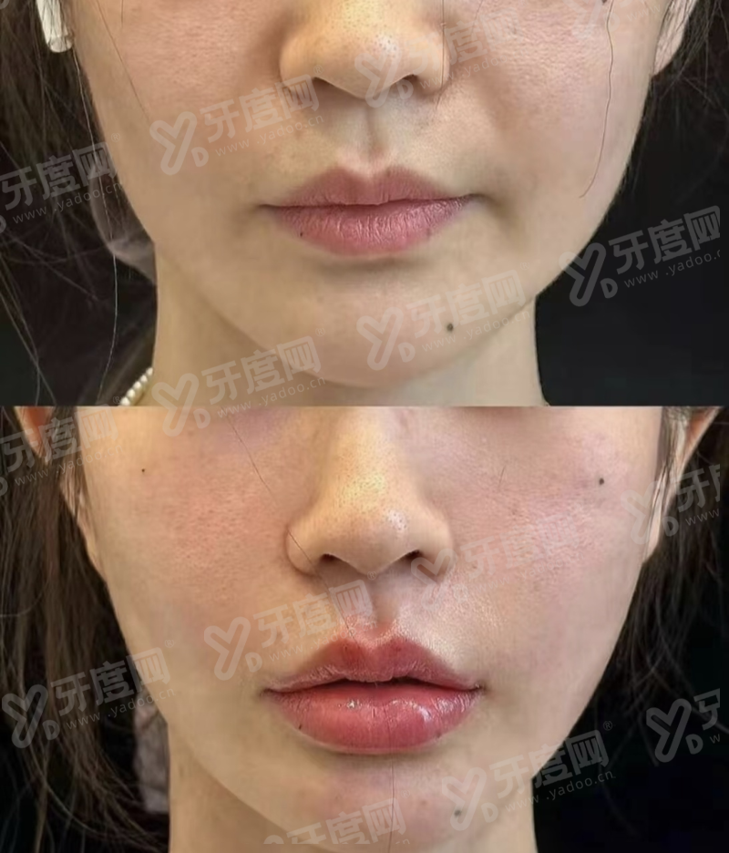 香港缪诗miusee怎么约最快？甜伊严选小程序当天锁定档期，一键查询热门项目，轻松变美不等待！