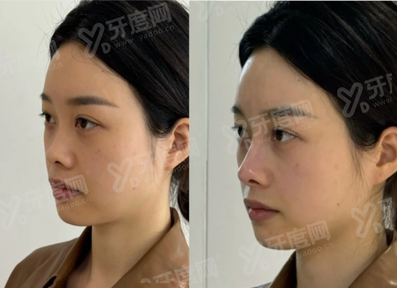二、准备预约香港EVR医美做医美项目可以通过甜伊严选预约怎么样?yanke.yadoo.cn