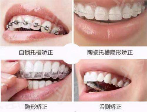 二、深圳新安麦芽口腔口碑怎么样?真实患者分享见证极速修复奇迹yanke.yadoo.cn