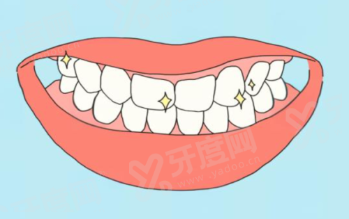 二、重庆牙博士口腔看牙真的靠谱吗?真人实例与预约指南全揭秘yanke.yadoo.cn