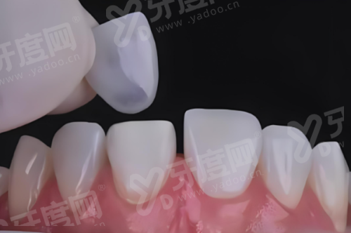 哈尔滨团圆口腔怎么样？3 级专科 + 一曼街 50 号 + 健保定点 + 全年无休看牙更方便穿颧种植当天用
