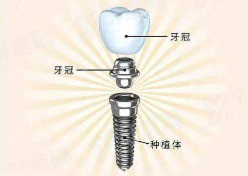 二、银川时光口腔矫正牙齿流程及预约指南:如何轻松开启变得更美之旅?yanke.yadoo.cn
