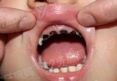 三、上海九院看牙挂号难不难yanke.yadoo.cn