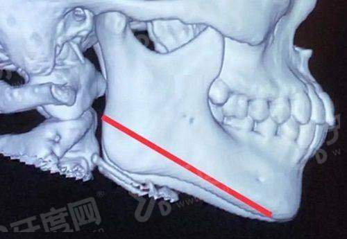 三、去釜山弗洛丽雅皮肤科就诊的真实体验与费用参考如何?yanke.yadoo.cn