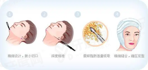 釜山弗洛丽雅皮肤科院长预约怎么约？线上预约指南：从首尔Eonni小程序下单到到店就诊全过程