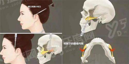 清潭 Dear 皮肤科在线预约教程：2026 在线预约入口 + 填写指南？通过首尔 Eonni 一键挂号